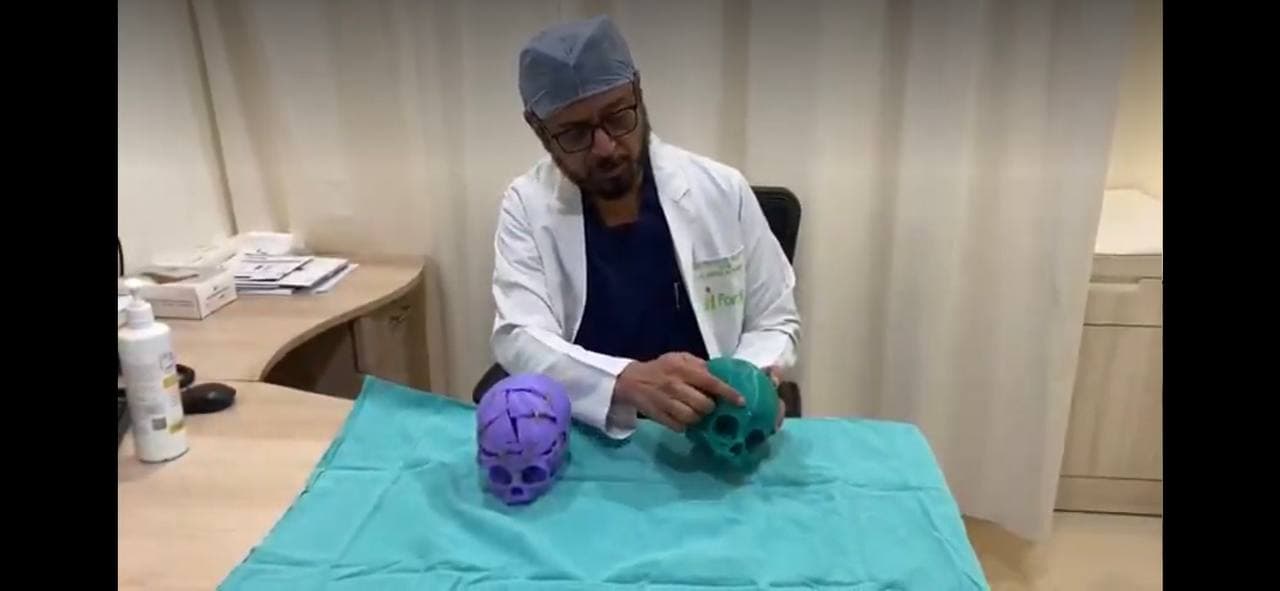 Autoabode 3D printed anatomical model for pre-surgical planning — craniofacial reconstruction